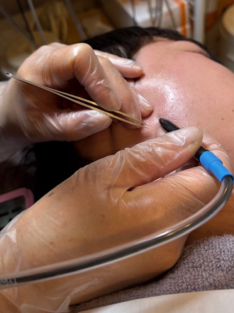 脱毛器の安全規格について